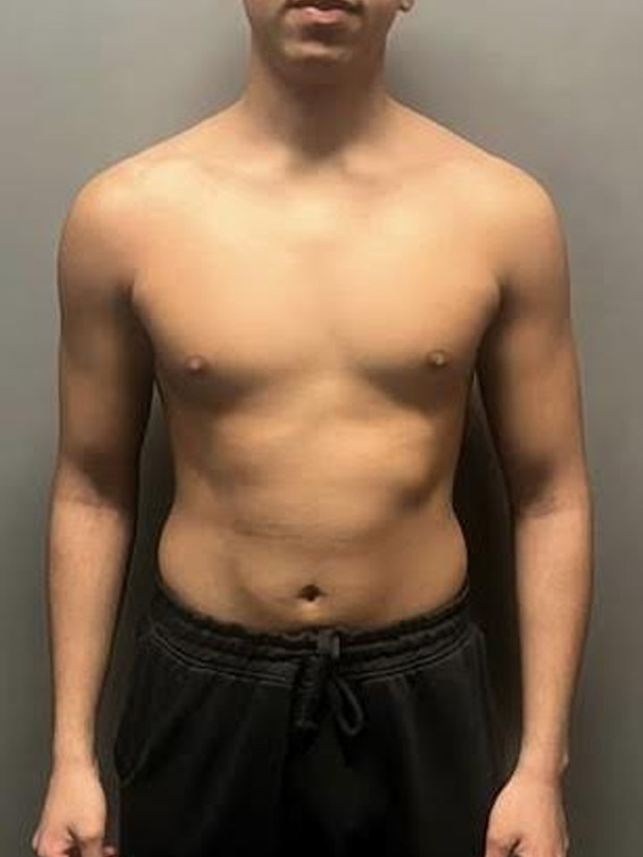 Before photo of Isa Malik