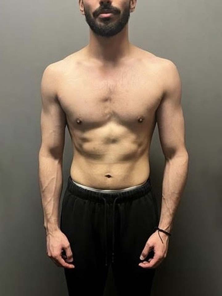 After photo of Anurag Janghala