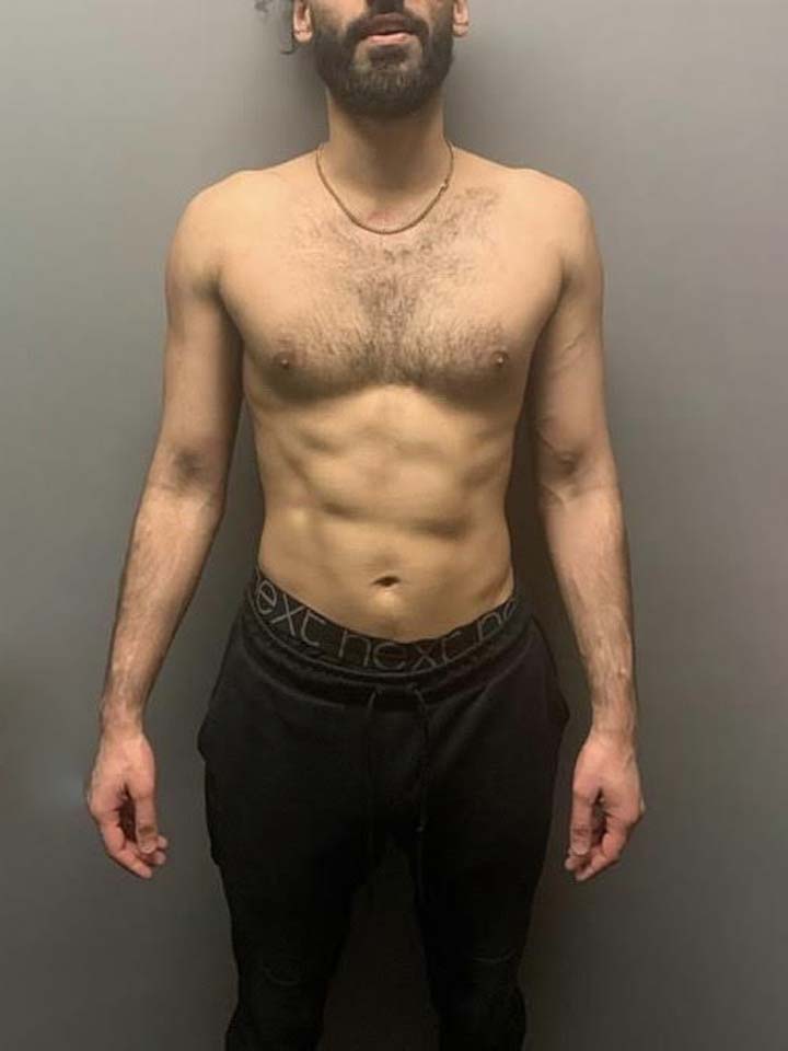 After photo of Bilal Khan