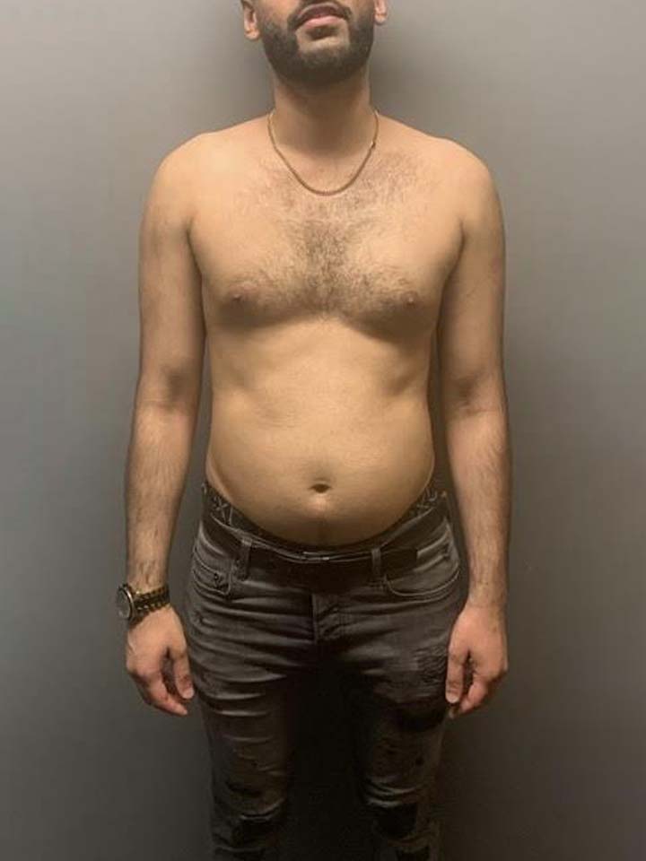 Before photo of Bilal Khan