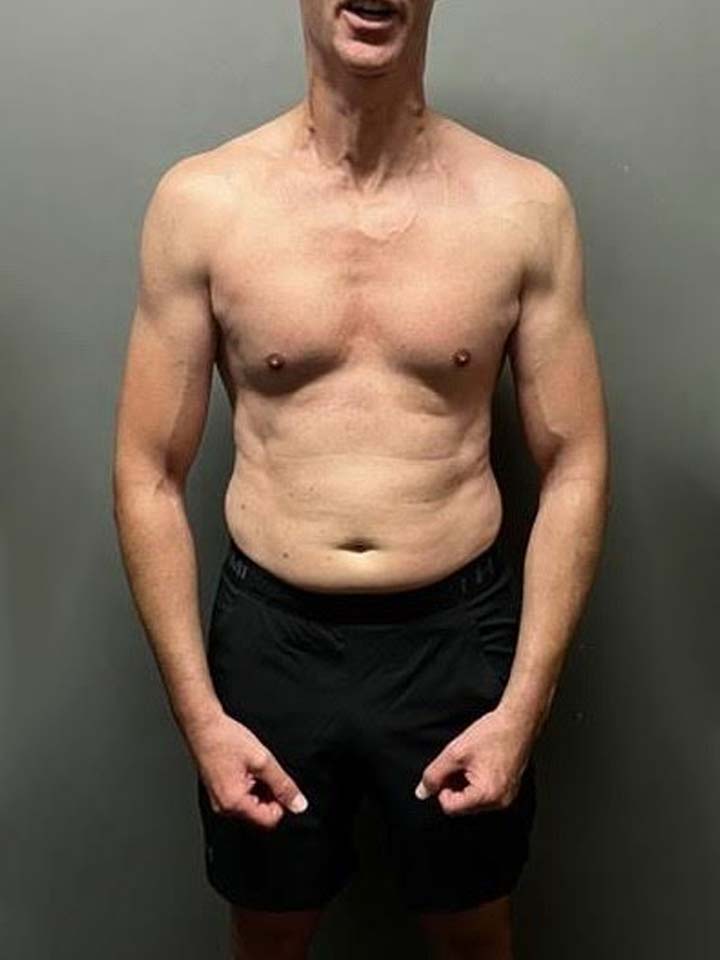 After photo of Phil Ashcroft