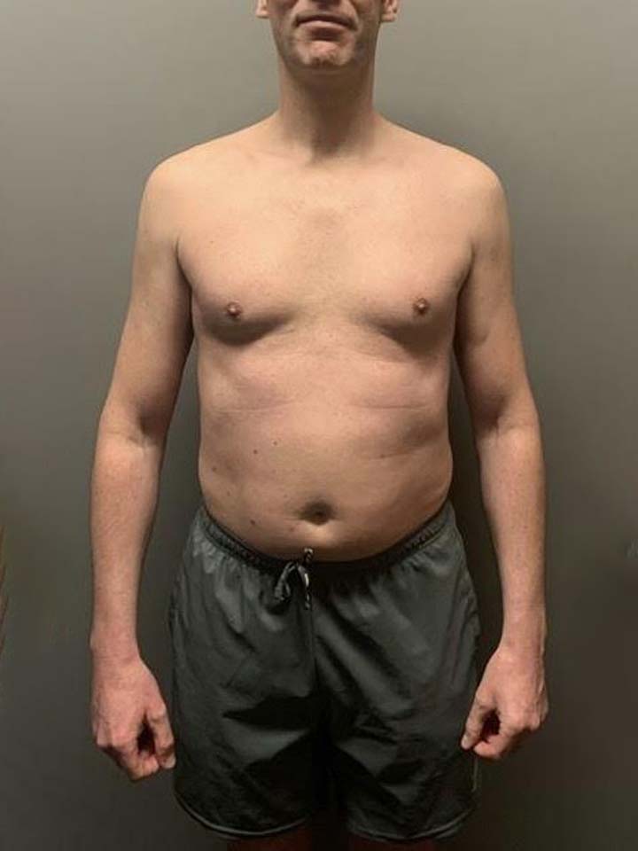 Before photo of Phil Ashcroft