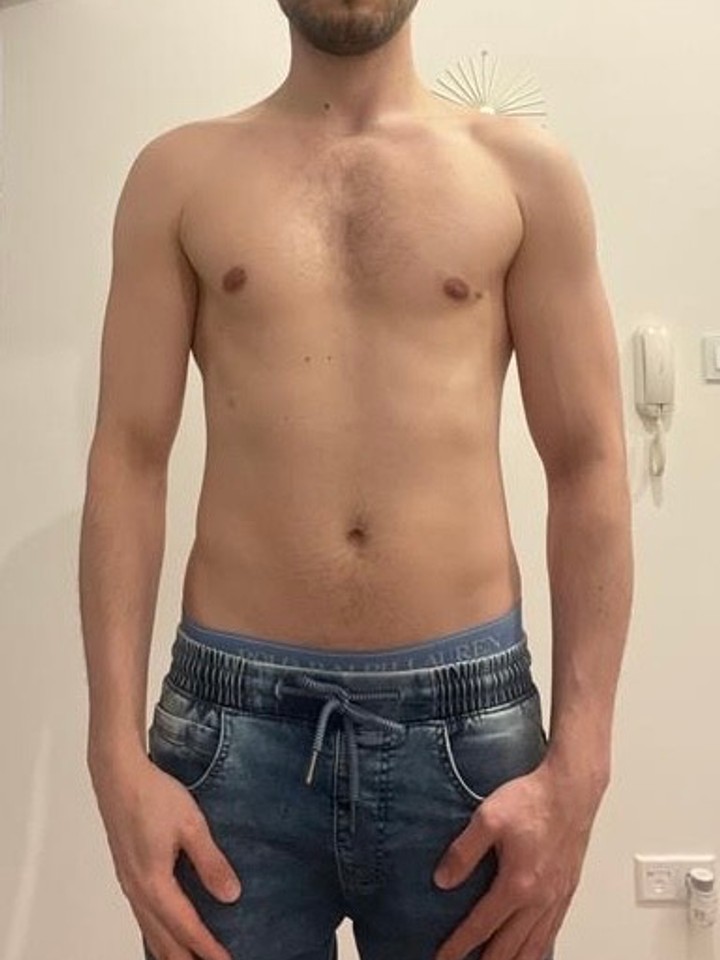 Before photo of Łukasz Sierawski