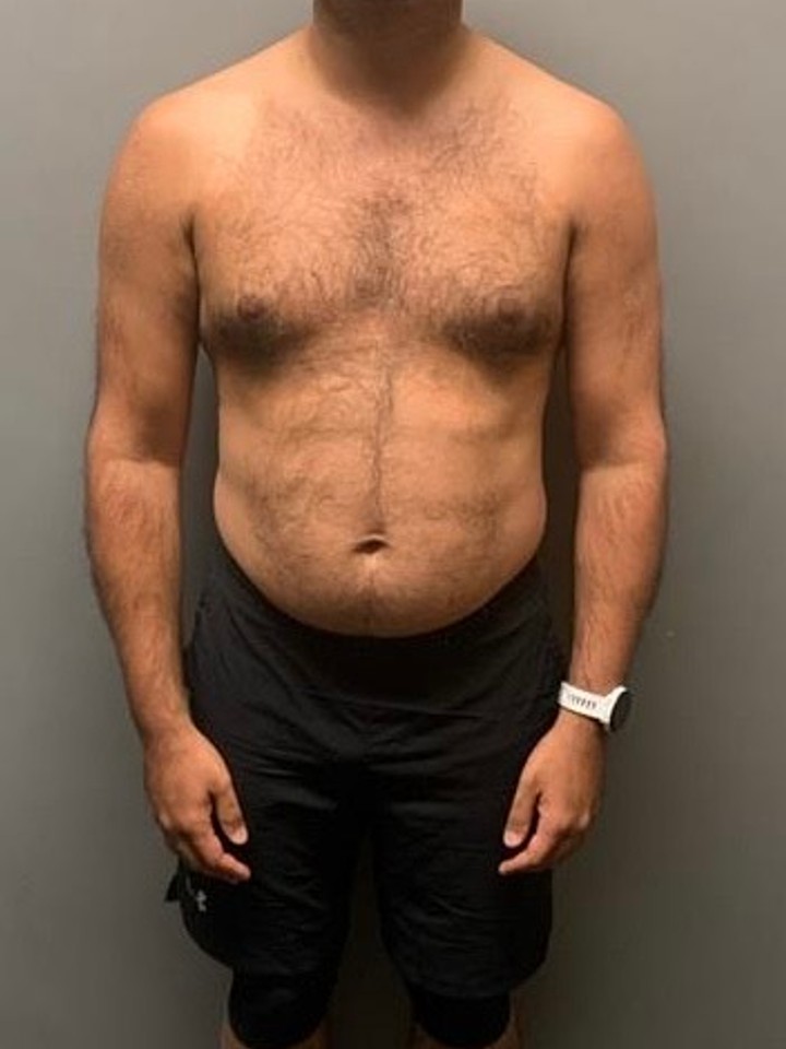 Before photo of Mohsin Hanif