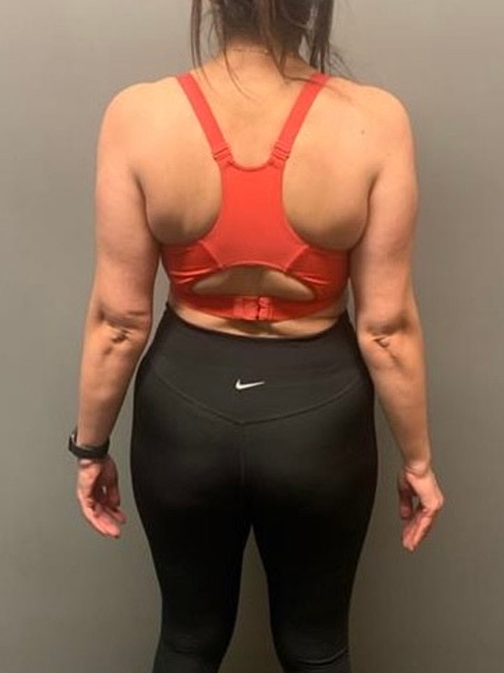 After photo of Sarah Saleem