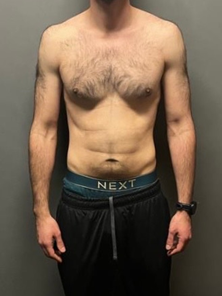 Before photo of Gemal Mekki