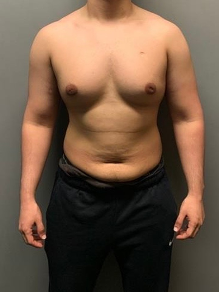 Before photo of Ahmed Bin Hadi