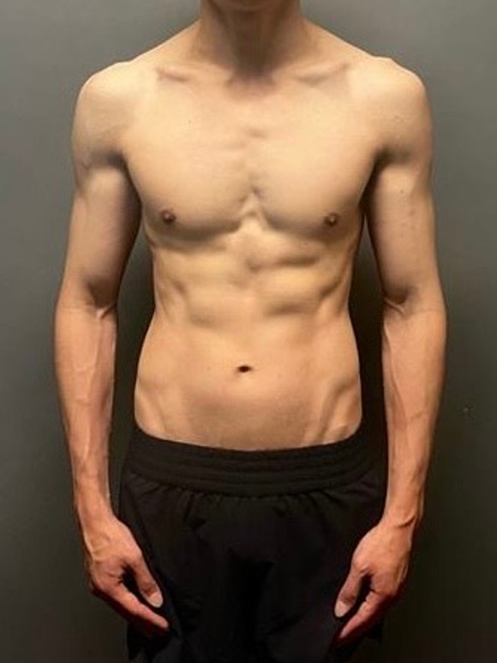 After photo of Oliver Chun Long