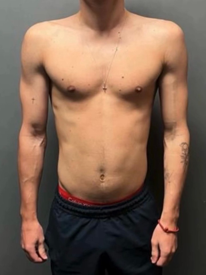 Before photo of James Fielding